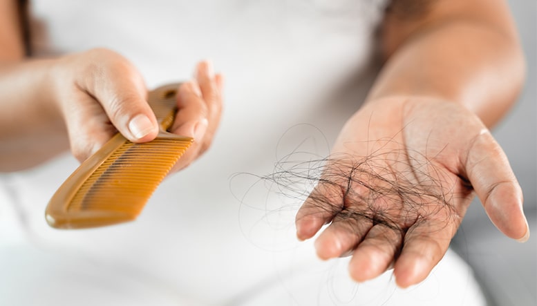 Chute des greffons après-une-opération de greffe de cheveux