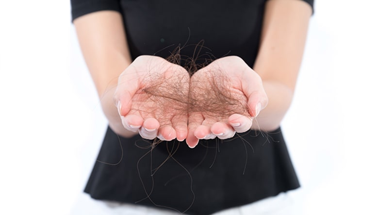 Chutent cheveux après une greffe