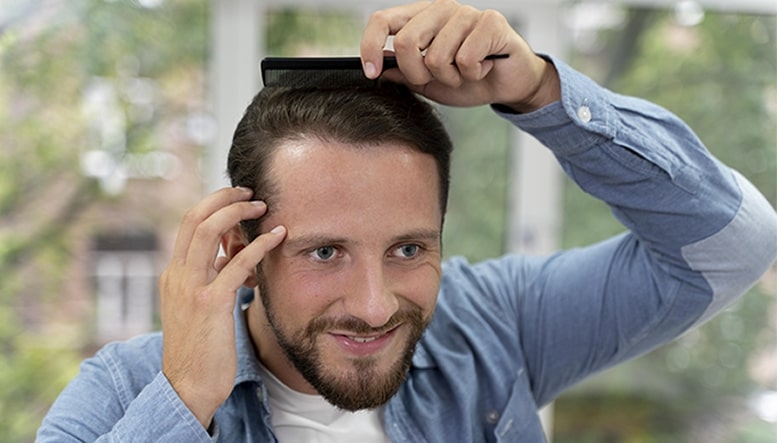 meilleur âge pour avoir une greffe de cheveux