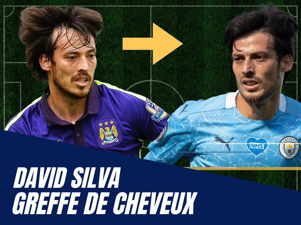 David Silva avant apres