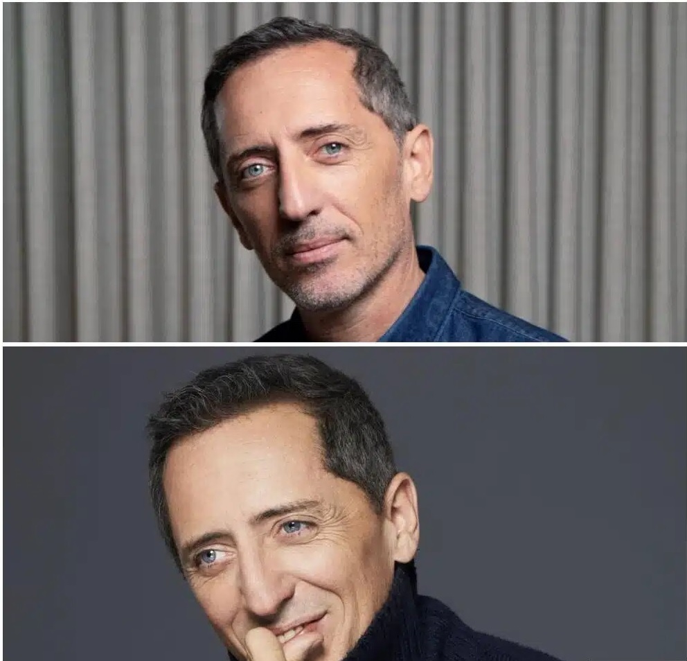 greffe-cheveux-Gad-Elmaleh