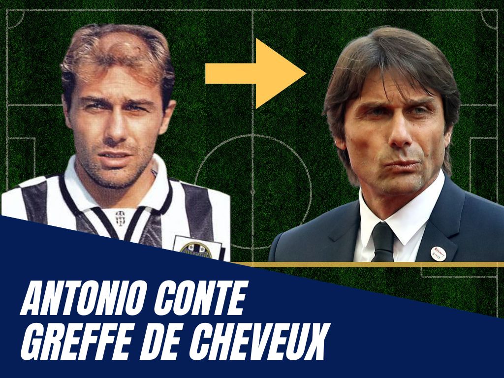 Antonio Conte avant apres