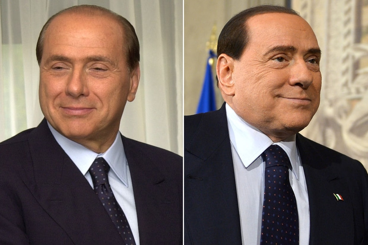 Silvio Berlusconi avant apres
