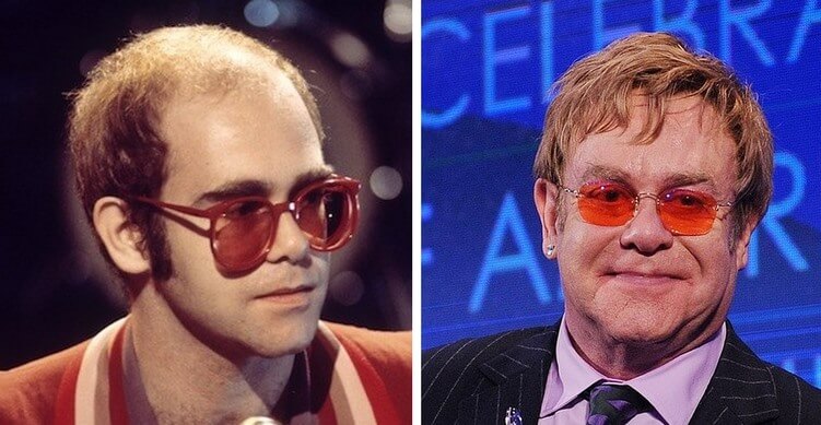 Elton John avant apres
