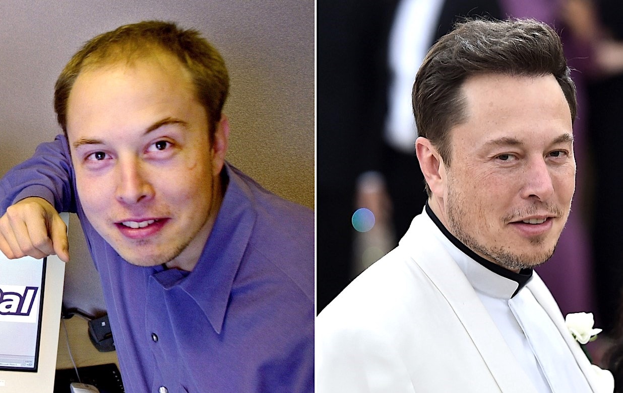 Elon Musk avant apres