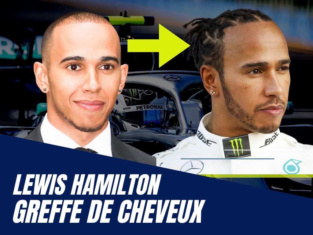 Lewis Hamilton avant apres